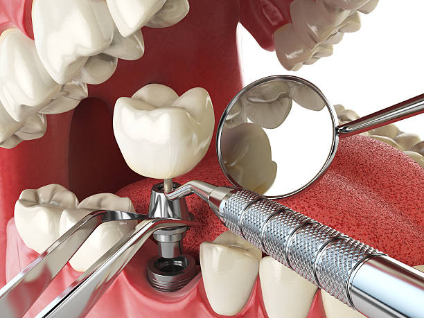 Best Mobile Emergency Dentist in Iron River, MI